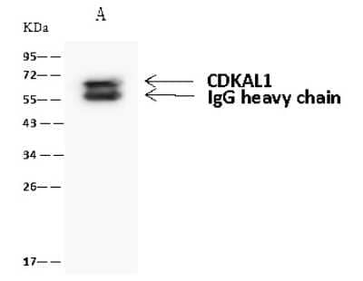 Immunoprecipitation: CDKAL1 Antibody [NBP2-98668] - CDKAL1 was immunoprecipitated using: Lane A: 0.5 mg HeLa Whole Cell Lysate 4 ul anti-CDKAL1 rabbit polyclonal antibody and 60 ug of Immunomagnetic beads Protein A/G.  Primary antibody: Anti-CDKAL1 rabbit polyclonal antibody, at 1:100 dilution. Secondary antibody: Goat Anti-Rabbit IgG (H+L)/HRP at 1/10000 dilution. Developed using the ECL technique. Performed under reducing conditions. Predicted band size: 65 kDa. Observed band size: 65 kDa