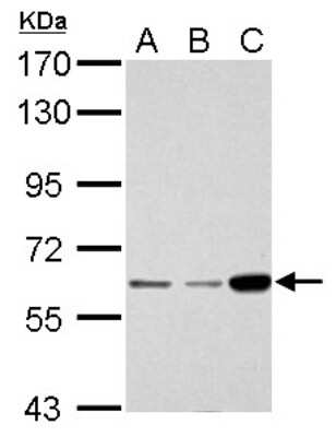 Western Blot: CDKAL1 Antibody [NBP1-32796] - A. 30 ug Jurkat whole cell lysate/extract, B. 30 ug Raji whole cell lysate/extract, C. 30 ug K562 whole cell lysate/extract 7. 5 % SDS-PAGE gel, antibody dilution 1:1000.