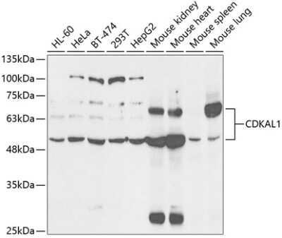 Western Blot CDKAL1 Antibody - BSA Free