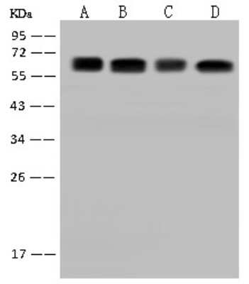 Western Blot CDKAL1 Antibody