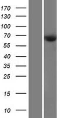 Western Blot CDKAL1 Overexpression Lysate