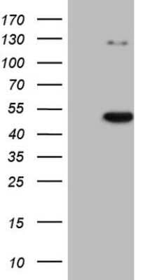 Western Blot: CDKL1 Antibody (1D9) [NBP2-46217] - Analysis of HEK293T cells were transfected with the pCMV6-ENTRY control (Left lane) or pCMV6-ENTRY CDKL1.