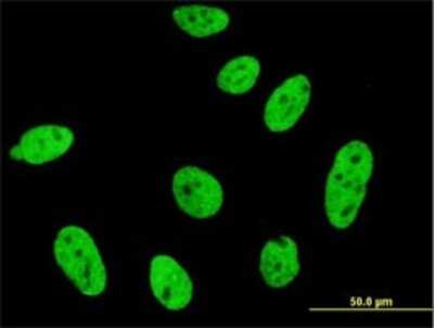 Immunocytochemistry/Immunofluorescence: CDKL1 Antibody (1F12) [H00008814-M03] - Analysis of monoclonal antibody to CDKL1 on HeLa cell. Antibody concentration 10 ug/ml