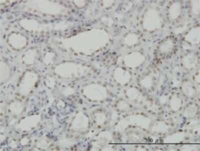 Immunohistochemistry-Paraffin: CDKL1 Antibody (1F12) [H00008814-M03] - Analysis of monoclonal antibody to CDKL1 on formalin-fixed paraffin-embedded human kidney. Antibody concentration 5 ug/ml