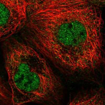 Immunocytochemistry/Immunofluorescence: CDKL1 Antibody [NBP2-32482] - Immunofluorescent staining of human cell line A-431 shows localization to nucleoplasm & vesicles.