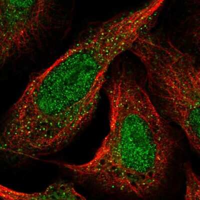 Immunocytochemistry/Immunofluorescence: CDKL1 Antibody [NBP2-57291] - Staining of human cell line U-2 OS shows localization to nucleoplasm & vesicles.