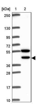 Western Blot: CDKL1 Antibody [NBP2-32482] - Lane 1: Marker  [kDa] 250, 130, 95, 72, 55, 36, 28, 17, 10.  Lane 2: Human cell line RT-4