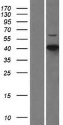 Western Blot: CDKL1 Overexpression Lysate (Adult Normal) [NBL1-09047] Left-Empty vector transfected control cell lysate (HEK293 cell lysate); Right -Over-expression Lysate for CDKL1.