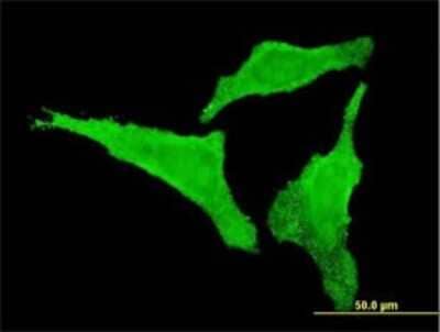 Immunocytochemistry/Immunofluorescence: CDKL2 Antibody (6H8) [H00008999-M02] - Analysis of monoclonal antibody to CDKL2 on HeLa cell . Antibody concentration 10 ug/ml.