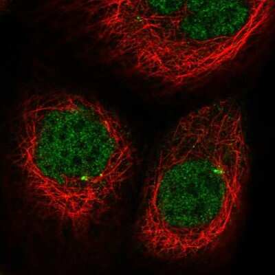 Immunocytochemistry/Immunofluorescence: CDKL2 Antibody [NBP1-82873] - Staining of human cell line A-431 shows localization to nucleoplasm & centrosome.