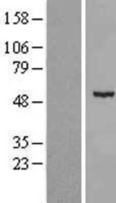 Western Blot: CDKL2 Overexpression Lysate (Adult Normal) [NBL1-09048] Left-Empty vector transfected control cell lysate (HEK293 cell lysate); Right -Over-expression Lysate for CDKL2.