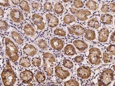 Immunohistochemistry-Paraffin: CDKL4 Antibody [NBP2-97193] - Immunochemical staining of human CDKL4 in human stomach with rabbit polyclonal antibody at 1:500 dilution, formalin-fixed paraffin embedded sections.