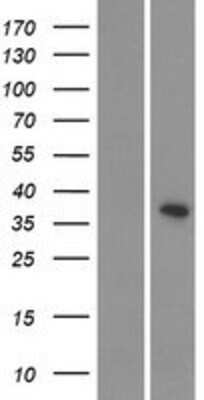 Western Blot: CDKL4 Overexpression Lysate (Adult Normal) [NBP2-08705] Left-Empty vector transfected control cell lysate (HEK293 cell lysate); Right -Over-expression Lysate for CDKL4.