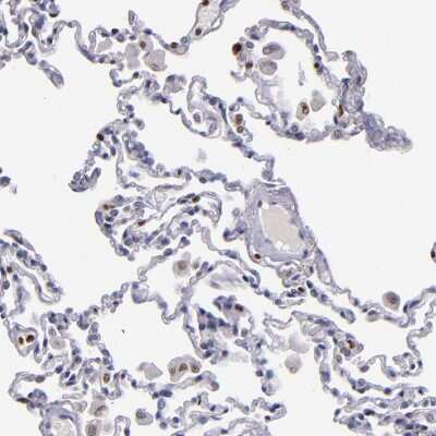 Immunohistochemistry-Paraffin: CDKL5 Antibody [NBP1-84881] - Staining of human lung shows moderate nuclear positivity in macrophages.