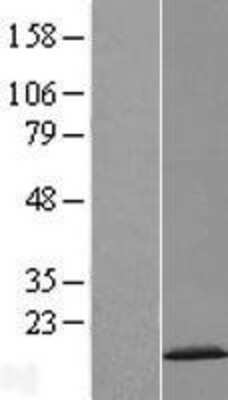 Western Blot: CDKN2A Interacting protein N-Terminal Like Overexpression Lysate (Adult Normal) [NBL1-09054] Left-Empty vector transfected control cell lysate (HEK293 cell lysate); Right -Over-expression Lysate for CDKN2A Interacting protein N-Terminal Like.