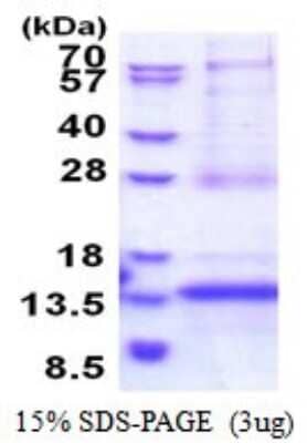 SDS-Page: CDKN2A Interacting protein N-Terminal Like Recombinant Protein [NBP2-51567] - 15% SDS Page (3 ug)