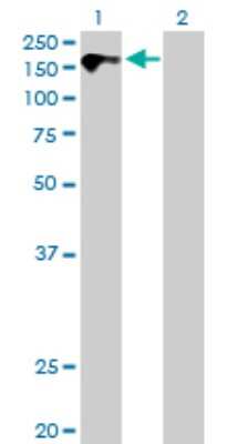 Western Blot: CDO Antibody [H00050937-B01P] - Analysis of CDON expression in transfected 293T cell line by CDON polyclonal antibody.  Lane 1: CDON transfected lysate(141.57 KDa). Lane 2: Non-transfected lysate.