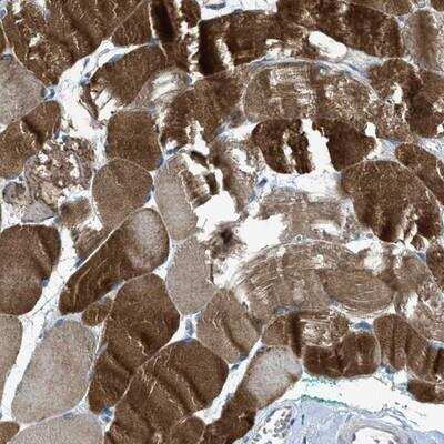 Immunohistochemistry-Paraffin: CDO Antibody [NBP1-85700] - CDON/Cdo Antibody [NBP1-85700] - Staining of human skeletal muscle shows strong positivity in subtypes of myocytes.
