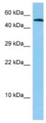 Western Blot: CDP/CUTL1 Antibody [NBP3-10866] - Western blot analysis of CDP/CUTL1 in Mouse Small Intestine lysates. Antibody dilution at 1ug/ml