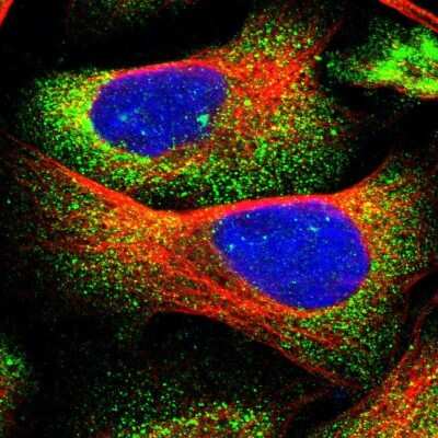 Immunocytochemistry/Immunofluorescence: CDR2L Antibody [NBP1-93681] - Immunofluorescent staining of human cell line U-2 OS shows localization to cytosol.