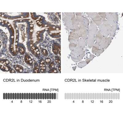 <b>Orthogonal Strategies Validation. </b>Immunohistochemistry-Paraffin: CDR2L Antibody [NBP1-93681] - Analysis in human duodenum and skeletal muscle tissues. Corresponding CDR2L RNA-seq data are presented for the same tissues.