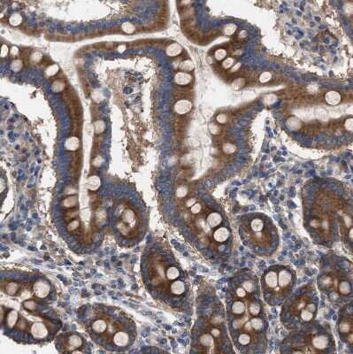 Immunohistochemistry-Paraffin: CDR2L Antibody [NBP1-93681] - Staining of human duodenum shows strong cytoplasmic positivity in glandular cells.