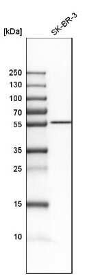 Western Blot: CDR2L Antibody [NBP1-93681] - Analysis in human cell line SK-BR-3.