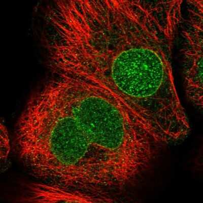 Immunocytochemistry/Immunofluorescence: CDS1 Antibody [NBP1-85894] - Staining of human cell line A-431 shows localization to nucleus & nuclear membrane. Antibody staining is shown in green.