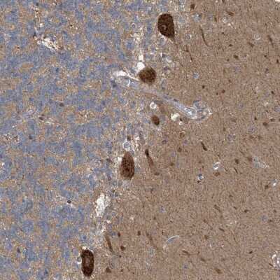 Immunohistochemistry-Paraffin: CDS1 Antibody [NBP1-85894] - Staining of human cerebellum shows moderate cytoplasmic positivity in purkinje cells.