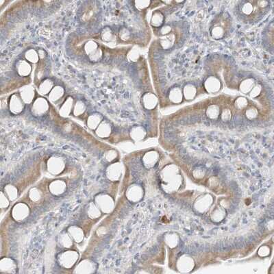 Immunohistochemistry-Paraffin: CDS1 Antibody [NBP1-85894] - Staining of human duodenum shows moderate positivity in glandular cells.