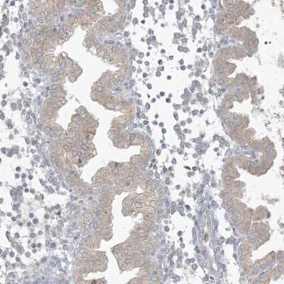 Immunohistochemistry-Paraffin: CDS1 Antibody [NBP1-85894] - Staining of human endometrium shows weak cytoplasmic positivity in glandular cells.