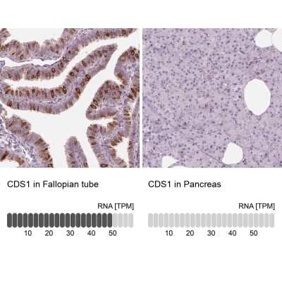 <b>Orthogonal Strategies Validation. </b>Immunohistochemistry-Paraffin: CDS1 Antibody [NBP2-62643] - Immunohistochemistry analysis in human fallopian tube and pancreas tissues using Anti-CDS1 antibody. Corresponding CDS1 RNA-seq data are presented for the same tissues.