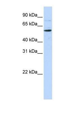 Western Blot: CDS1 Antibody [NBP1-59495] - 293T cells lysate, concentration 0.2-1 ug/ml.