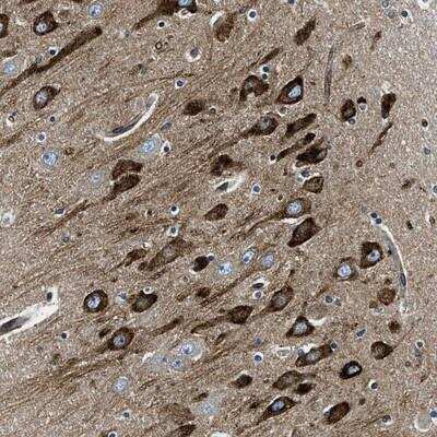 Immunohistochemistry-Paraffin CDS2 Antibody