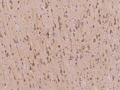 Immunohistochemistry-Paraffin: CDS2 Antibody [NBP2-97196] - Immunochemical staining of human CDS2 in human brain with rabbit polyclonal antibody at 1:5000 dilution, formalin-fixed paraffin embedded sections.