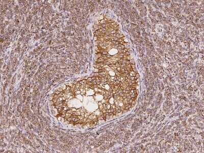 Immunohistochemistry-Paraffin: CDS2 Antibody [NBP2-97196] - Immunochemical staining of human CDS2 in human testis with rabbit polyclonal antibody at 1:5000 dilution, formalin-fixed paraffin embedded sections.