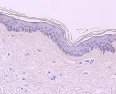 Immunohistochemistry-Paraffin: CDT1 Antibody (JA30-81) [NBP2-66768] - Analysis of paraffin-embedded human skin tissue using anti-CDT1 antibody. Counter stained with hematoxylin.