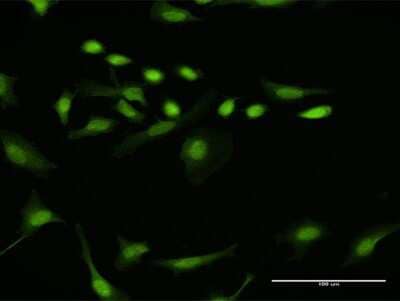 Immunocytochemistry/Immunofluorescence: CDT2 Antibody [H00051514-D01P] - Analysis of antibody to DTL on HeLa cell. Antibody concentration 10 ug/ml.