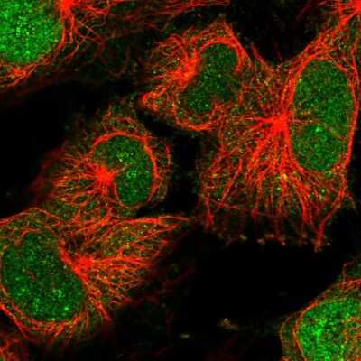 Immunocytochemistry/Immunofluorescence: CDT2 Antibody [NBP2-58215] - Staining of human cell line U-251 MG shows localization to nucleus, nucleoli & cytosol.