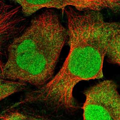 Immunocytochemistry/Immunofluorescence: CDT2 Antibody [NBP2-58216] - Staining of human cell line U-2 OS shows localization to nucleus & cytosol.