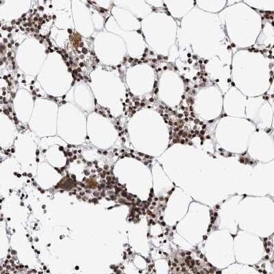 Immunohistochemistry-Paraffin: CDT2 Antibody [NBP1-85283] - Staining of human bone marrow shows strong nuclear positivity in bone marrow poietic cells.