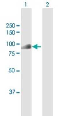 Western Blot CDT2 Antibody