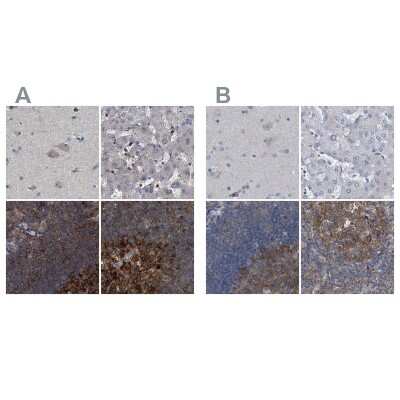 Immunohistochemistry-Paraffin: CDV3 Antibody [NBP1-81779] - Staining of human cerebral cortex, liver, lymph node and tonsil using Anti-CDV3 antibody NBP1-81779 (A) shows similar protein distribution across tissues to independent antibody NBP1-81781 (B).