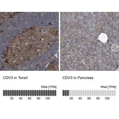 <b>Orthogonal Strategies Validation. </b>Immunohistochemistry-Paraffin: CDV3 Antibody [NBP1-81780] - Staining in human tonsil and pancreas tissues using anti-CDV3 antibody. Corresponding CDV3 RNA-seq data are presented for the same tissues.