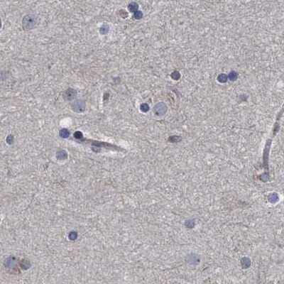 Immunohistochemistry-Paraffin: CDV3 Antibody [NBP1-81780] - Staining of human cerebral cortex.