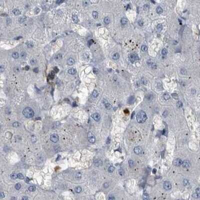 Immunohistochemistry-Paraffin: CDV3 Antibody [NBP1-81780] - Staining of human liver.
