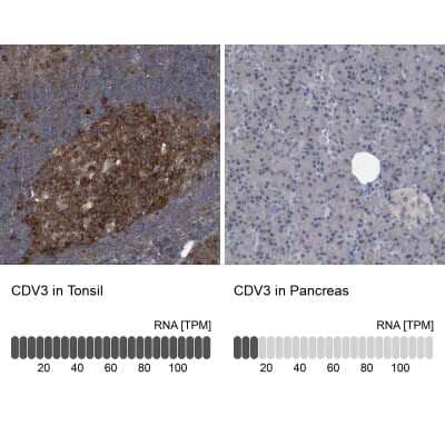 Immunohistochemistry-Paraffin: CDV3 Antibody [NBP1-81781] - Staining in human tonsil and pancreas tissues using anti-CDV3 antibody. Corresponding CDV3 RNA-seq data are presented for the same tissues.