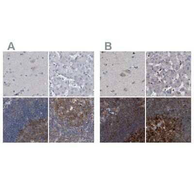 <b>Independent Antibodies Validation and Orthogonal Strategies Validation.</b>Immunohistochemistry-Paraffin: CDV3 Antibody [NBP1-81781] - Staining of human cerebral cortex, liver, lymph node and tonsil using Anti-CDV3 antibody NBP1-81781 (A) shows similar protein distribution across tissues to independent antibody NBP1-81779 (B).