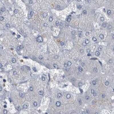 Immunohistochemistry-Paraffin: CDV3 Antibody [NBP1-81781] - Staining of human liver.