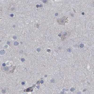Immunohistochemistry-Paraffin: CDV3 Antibody [NBP1-81781] - Staining of human cerebral cortex.